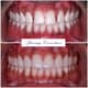 Slider image (7) FMS Dental Hospital - Kukatpally